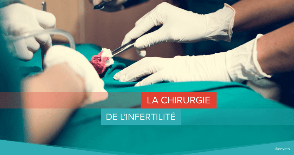 La chirurgie de l’infertilité