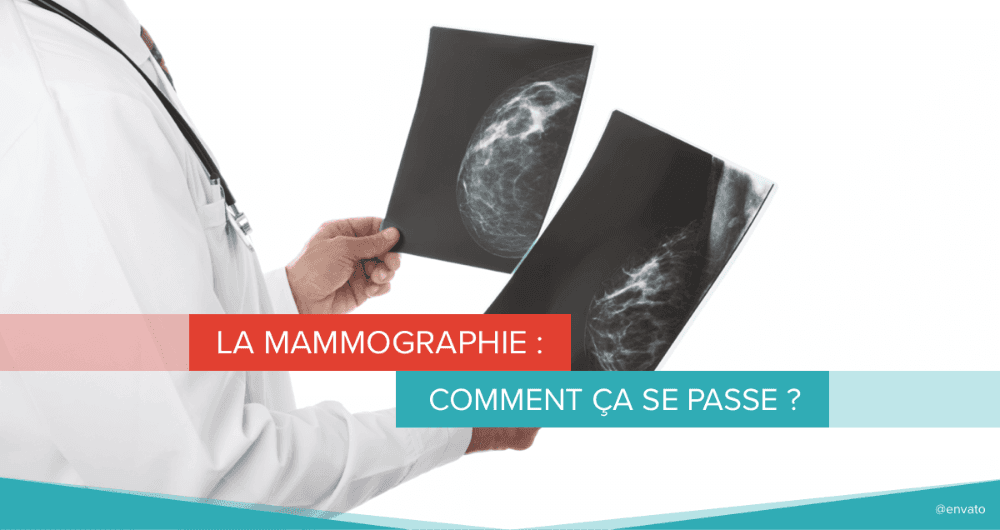 La mammographie : comment ça se passe ?