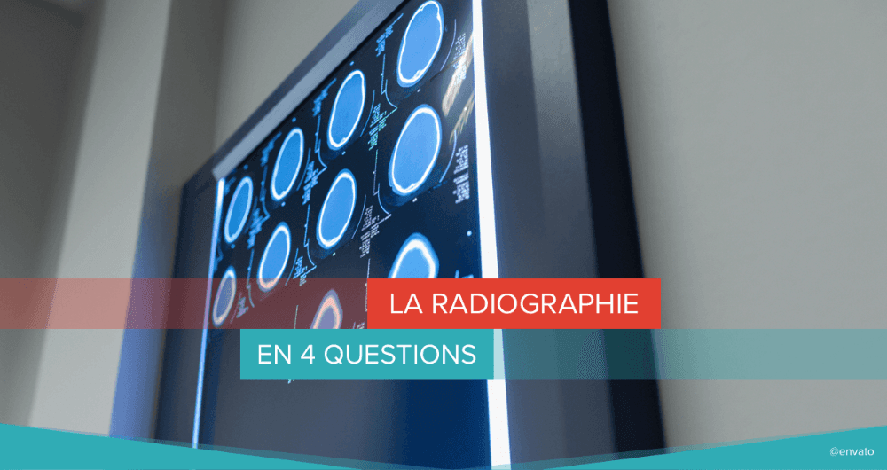 La radiographie en 4 questions