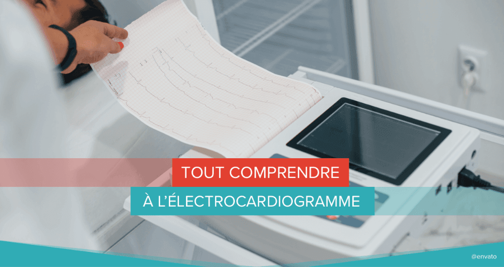 Tout comprendre à l’électrocardiogramme