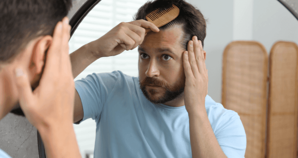 Alopécie : reconnaître, comprendre et traiter la chute des cheveux