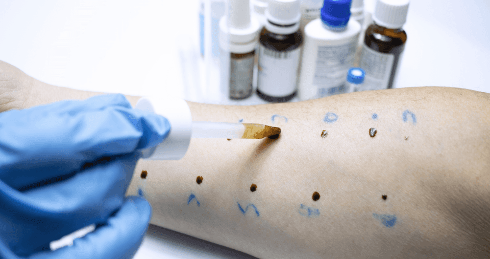 Comment soigner efficacement les maladies de la peau ?