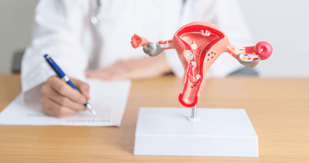 Endométriose et infertilité