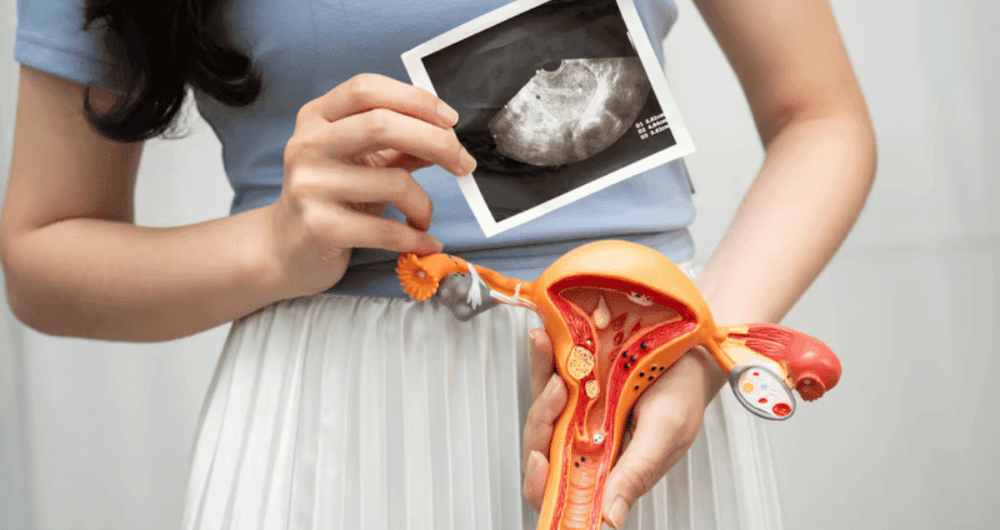 SOPK et fertilité : comprendre et optimiser vos chances de conception